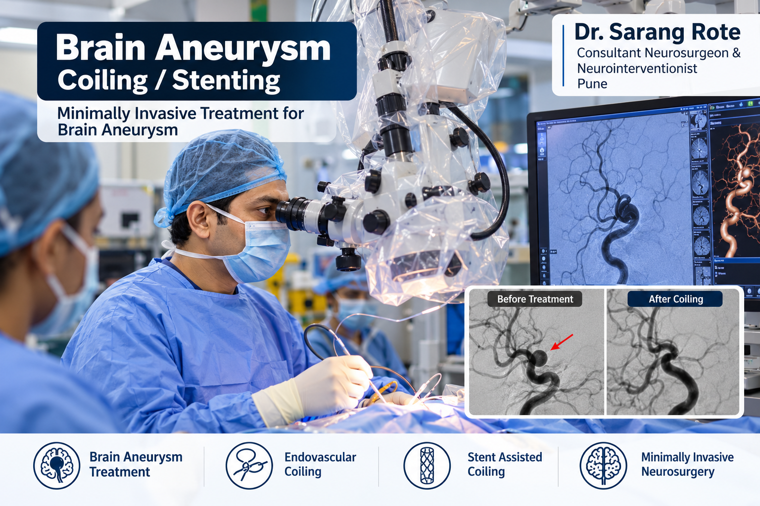 Brain Aneurysm Treatment by Dr. Sarang Rote in Pune